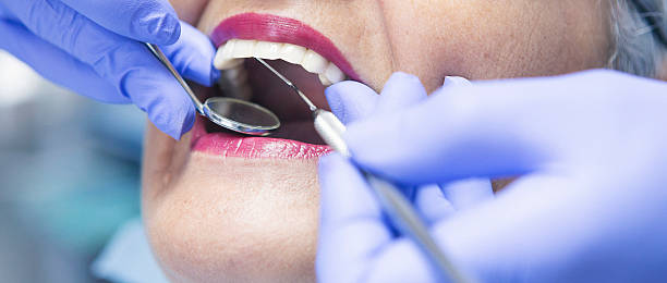 Best Emergency Dental Surgery in Steubenville, OH